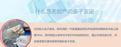 山西怀孕几个月如何办理胎儿血缘检测，山西无创产前亲子鉴定价格收费
